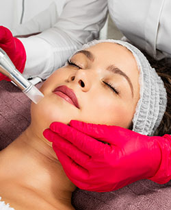 Microneedling Near Me Serving South Riding, Aldie, VA