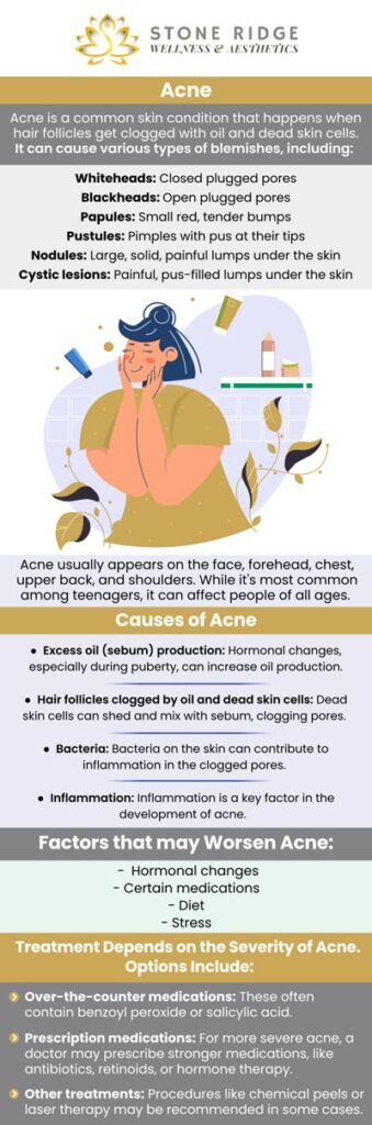 Our acne specialists at Stone Ridge Wellness & Aesthetics provide incredible acne treatments for every skin type! Achieve your acne-free goals at Stone Ridge Wellness & Aesthetics with Dr. Ria Shirsolkar, MD, MS and Emma Davis, FNP. Their team will help you achieve a more youthful and brighter look. To book your slot, contact us today or schedule an appointment online. We are conveniently located at 24560 Southpoint Dr, Suite 220, Aldie, VA 20105. Our acne specialists at Stone Ridge Wellness & Aesthetics provide incredible acne treatments for every skin type! Achieve your acne-free goals at Stone Ridge Wellness & Aesthetics with Dr. Ria Shirsolkar, MD, MS and Emma Davis, FNP. Their team will help you achieve a more youthful and brighter look. To book your slot, contact us today or schedule an appointment online. We are conveniently located at 24560 Southpoint Dr, Suite 220, Aldie, VA 20105.