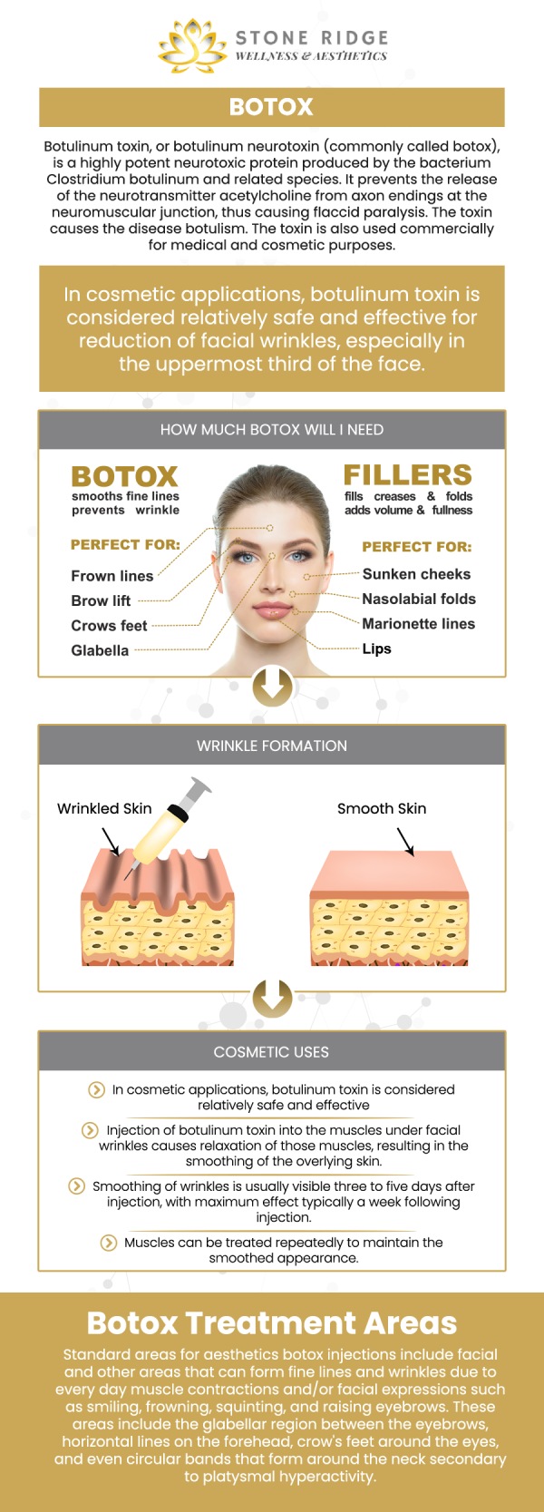 Botox is a well-known aesthetic treatment that effectively reduces the appearance of wrinkles and fine lines. It works by temporarily relaxing the specific facial muscles responsible for dynamic wrinkles. By blocking nerve signals to these muscles, Botox prevents them from contracting forcefully, which in turn smooths the overlying skin. Visit Dr. Ria Shirsolkar, MD, MS, at Stone Ridge Wellness and Aesthetics. For more information, contact us or request an appointment online. We are conveniently located at 24560 Southpoint Dr, Suite 220 Aldie, VA 20105.