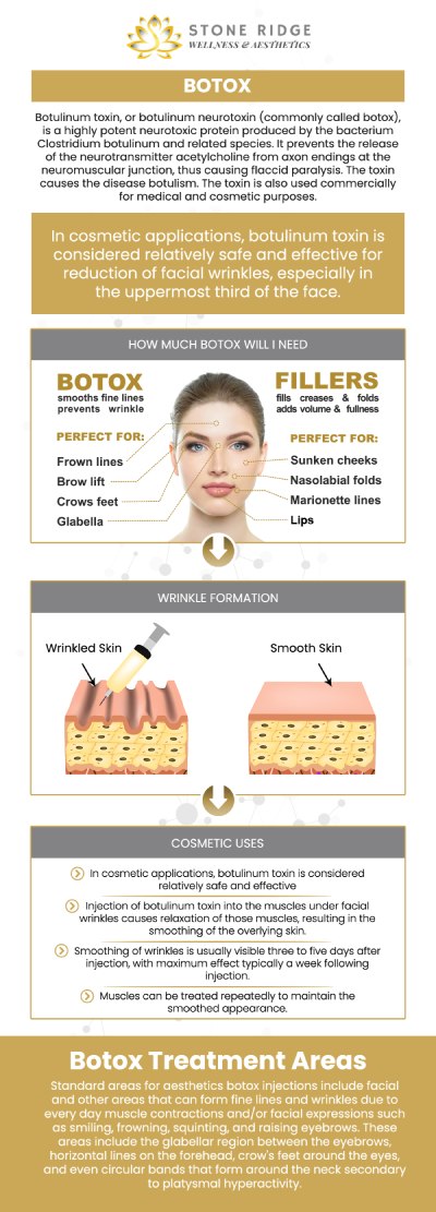 Botox is a cosmetic treatment that involves injecting botulinum toxins into the skin to lessen the appearance of wrinkles and fine lines. The main benefits of Botox are that the injections are safe, quick, and easy, and that Botox is a non-surgical wrinkle treatment. Botox can help you improve and boost your confidence, giving you a greater sense of self-assurance in your personal and professional life. For more information, contact us or request an appointment online. We are conveniently located at 24560 Southpoint Dr, Suite 220 Aldie, VA 20105. Botox is a cosmetic treatment that involves injecting botulinum toxins into the skin to lessen the appearance of wrinkles and fine lines. The main benefits of Botox are that the injections are safe, quick, and easy, and that Botox is a non-surgical wrinkle treatment. Botox can help you improve and boost your confidence, giving you a greater sense of self-assurance in your personal and professional life. For more information, contact us or request an appointment online. We are conveniently located at 24560 Southpoint Dr, Suite 220 Aldie, VA 20105.