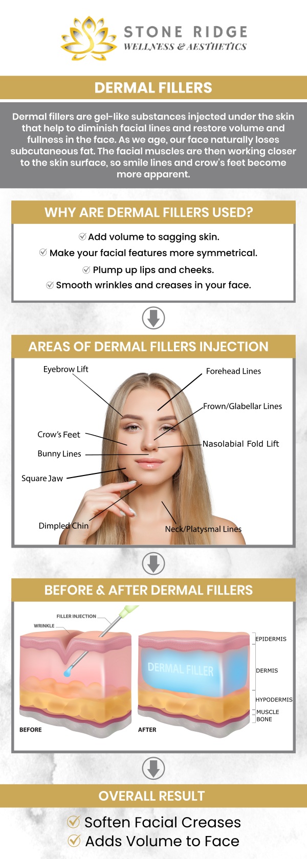 Dermal fillers are effective in enhancing the skin's elasticity, moisture, and texture, as well as its overall quality. A variety of skin issues caused by age and other reasons can be addressed with this reasonably short and non-invasive procedure. Achieve your aesthetic goals at Stone Ridge Wellness & Aesthetics with Dr. Ria Shirsolkar, MD, MS, and Emma David, FNP, and her team will help you achieve a more youthful and brighter look. To book your slot, contact us today or schedule an appointment online. We are conveniently located at 24560 Southpoint Dr, Suite 220 Aldie, VA 20105. Dermal fillers are effective in enhancing the skin's elasticity, moisture, and texture, as well as its overall quality. A variety of skin issues caused by age and other reasons can be addressed with this reasonably short and non-invasive procedure. Achieve your aesthetic goals at Stone Ridge Wellness & Aesthetics with Dr. Ria Shirsolkar, MD, MS, and her team. We will help you achieve a more youthful and brighter look. To book your slot, contact us today or schedule an appointment online. We are conveniently located at 24560 Southpoint Dr, Suite 220 Aldie, VA 20105.