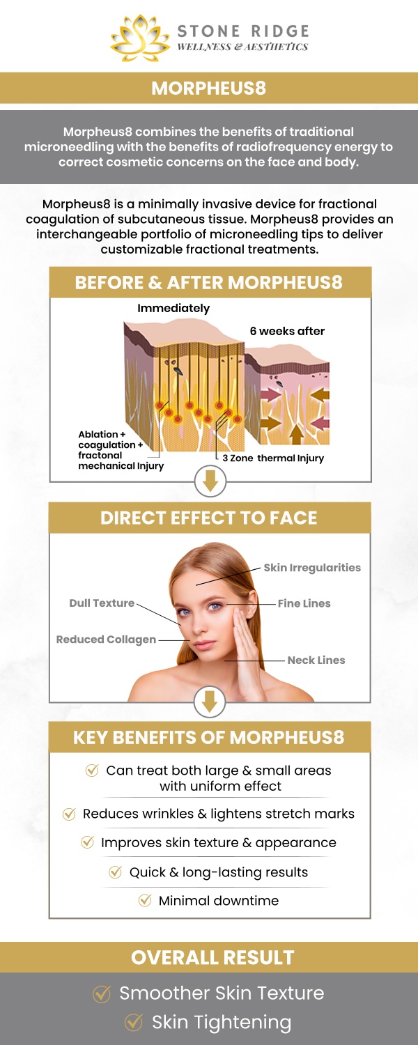 Experience the transformative effects of Morpheus8 at Stone Ridge Wellness and Aesthetics with Dr. Ria Shirsolkar, MD, MS. This innovative treatment combines microneedling with radiofrequency energy to stimulate collagen production, tightening and rejuvenating your skin. While you may feel some mild discomfort, the procedure requires minimal downtime and delivers noticeable results in just a few weeks. For more information, contact us or schedule an appointment online. We are located at 24560 Southpoint Dr, Suite 220, Aldie, VA 20105. Experience the transformative effects of Morpheus8 at Stone Ridge Wellness and Aesthetics with Dr. Ria Shirsolkar, MD, MS. This innovative treatment combines microneedling with radiofrequency energy to stimulate collagen production, tightening and rejuvenating your skin. While you may feel some mild discomfort, the procedure requires minimal downtime and delivers noticeable results in just a few weeks. For more information, contact us or schedule an appointment online. We are located at 24560 Southpoint Dr, Suite 220, Aldie, VA 20105.