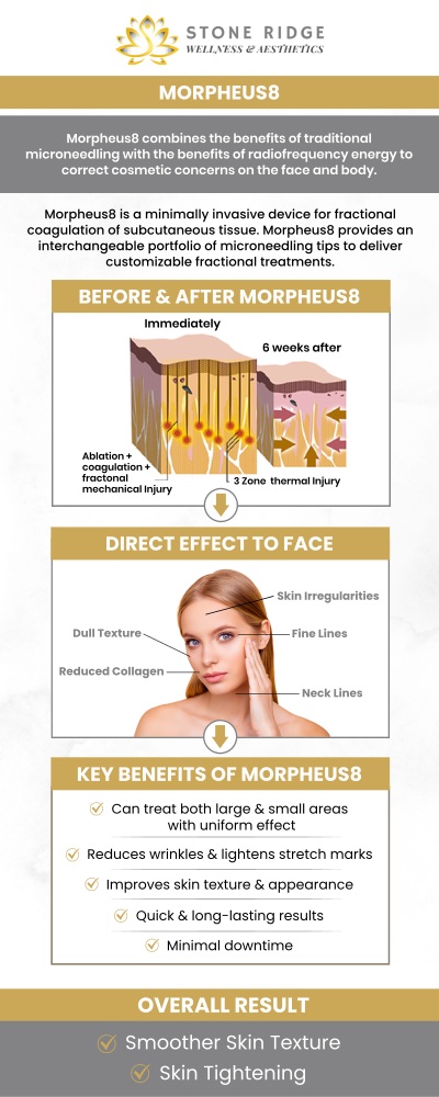 Morpheus8 targets deep layers of the skin. It stimulates collagen production, improving skin texture, reducing wrinkles, and tightening sagging areas. This non-invasive procedure can leave you with smoother, firmer, and more youthful-looking skin. Visit Dr. Ria Shilsolkar, MD, MS, to experience the transformative benefits of Morpheus8. For more information, contact us or request an appointment online. We are conveniently located at 24560 Southpoint Dr, Suite 220 Aldie, VA 20105.