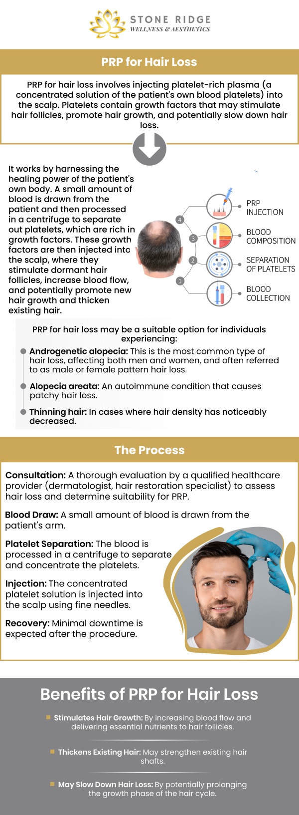 Common questions asked by clients: What is PRP for Hair Restoration? How does PRP help with hair restoration? What are the benefits of using PRP for hair growth? How many PRP sessions are needed for hair restoration? For more information, contact us or schedule an appointment online. We are conveniently located at 24560 Southpoint Dr, Suite 220 Aldie, VA 20105. We serve clients from Aldie VA, South Riding VA, Brambleton VA, Broadlands VA, Chantilly VA, Ashburn VA, Herndon VA, and surrounding areas. Common questions asked by clients: What is PRP for Hair Restoration? How does PRP help with hair restoration? What are the benefits of using PRP for hair growth? How many PRP sessions are needed for hair restoration? For more information, contact us or schedule an appointment online. We are conveniently located at 24560 Southpoint Dr, Suite 220 Aldie, VA 20105. We serve clients from Aldie VA, South Riding VA, Brambleton VA, Broadlands VA, Chantilly VA, Ashburn VA, Herndon VA, and surrounding areas.